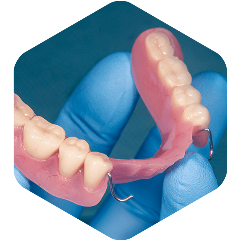 Partial dentures